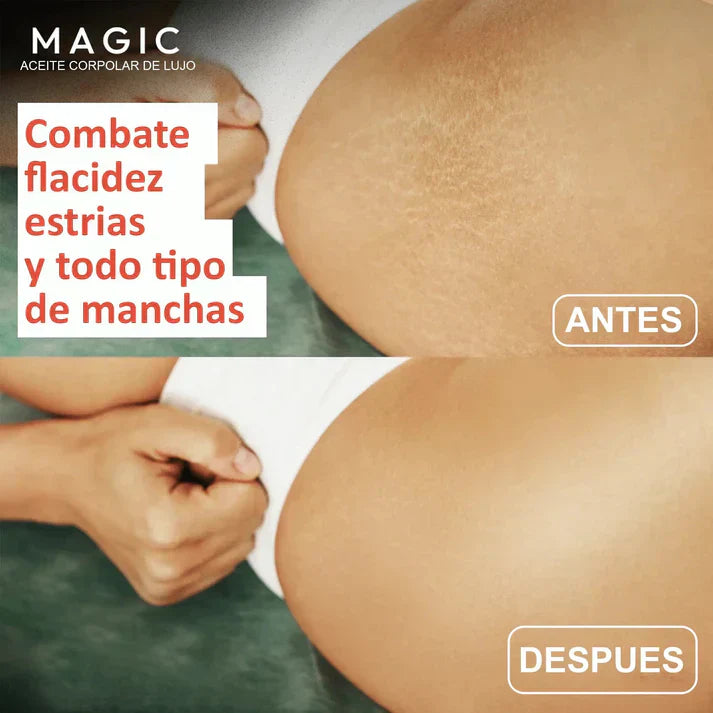 Aceite Corporal Magic™ - 100 ml