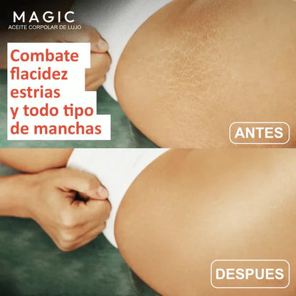 Aceite Corporal Magic™ - 100 ml